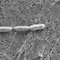 乳酸菌GR-1TM電子顕微鏡写真