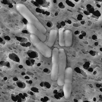 乳酸菌RC-14TM電子顕微鏡写真